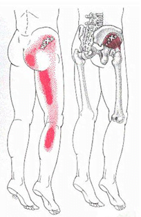 Hip, Groin and Thigh Pain - do you have a leg to stand on? - Align