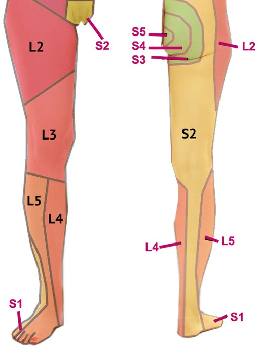 L L S Nerve Damage