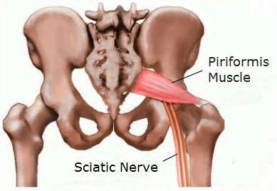 sciatic nerve dermatome