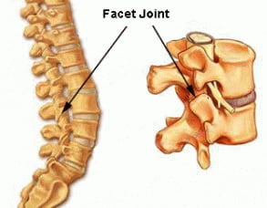 'Wear and Tear' on the spine - Align Body Clinic