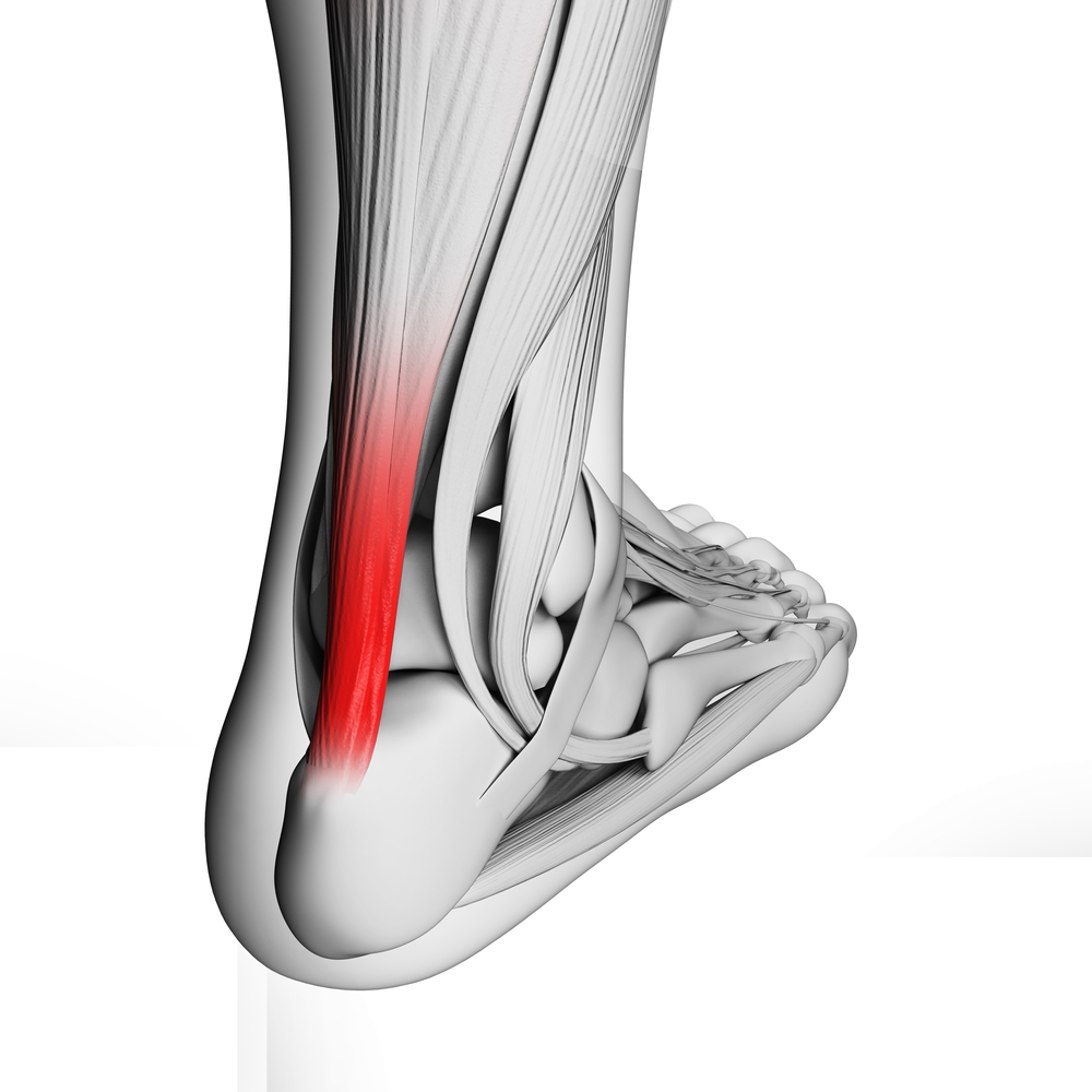 How do I stop my Achilles hurting when I run? Align Body Clinic